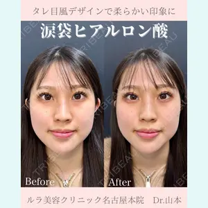 症例