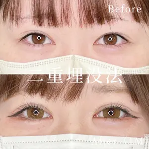 症例