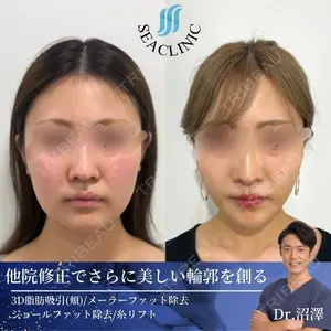 SEA CLINIC（シークリニック） 沼澤 茂医師の症例