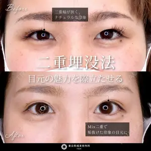 東京形成美容外科 船橋院 弓削田　浩主医師の症例