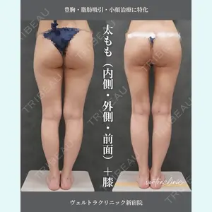 症例