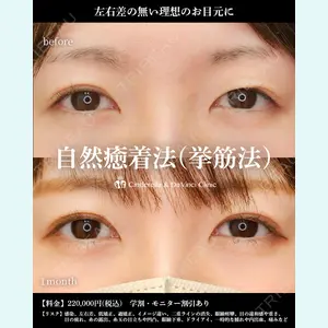 シンデレラ＆ダヴィンチクリニックの症例
