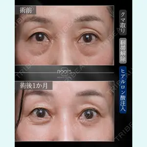 症例