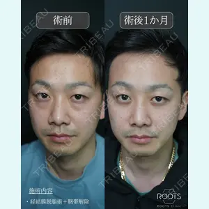 症例