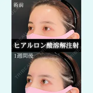 HAAB×DREAM BEAUTY CLINIC 大阪梅田院 鈴木 馨斗医師の症例