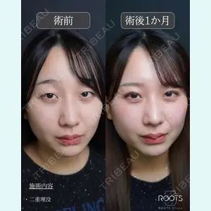 症例