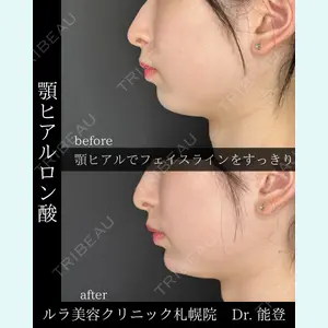 ルラ美容クリニック 札幌院 能登 貴弘医師の症例