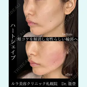 ルラ美容クリニック 札幌院 能登 貴弘医師の症例