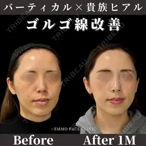 症例