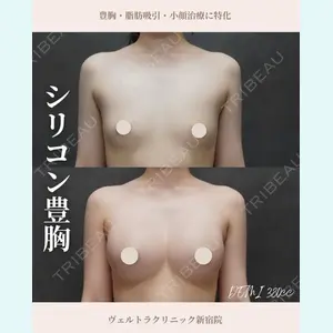 症例