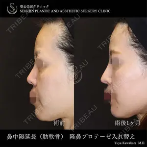 聖心美容クリニック 六本木院 川端 優也医師の症例
