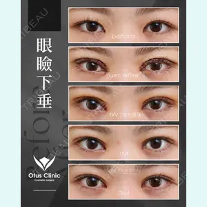 症例