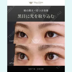 症例