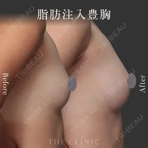 症例
