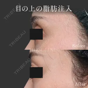 症例