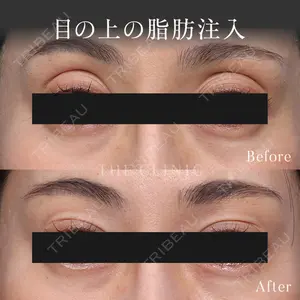 症例
