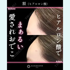 東京形成美容外科 銀座院 恩田　慶子医師の症例