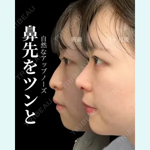 症例