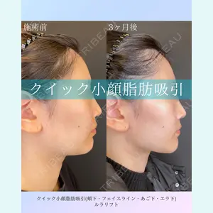 ルラ美容クリニック 札幌院 佐藤 雄紀医師の症例