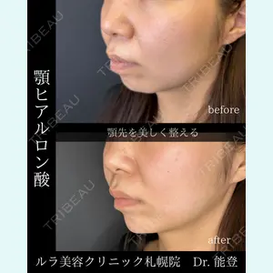 ルラ美容クリニック 札幌院 能登 貴弘医師の症例