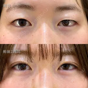 HAAB×DREAM BEAUTY CLINIC 東京本院 萩原 昂医師の症例
