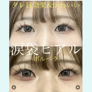 症例