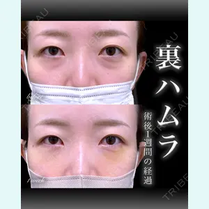 症例