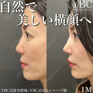 YBC横浜美容外科 大宮院 磯村 亮輔医師の症例