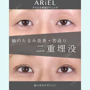 アリエル美容クリニック 郡山院 安齋 誠基医師の症例