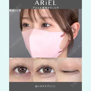アリエル美容クリニック 郡山院 安齋 誠基医師の症例