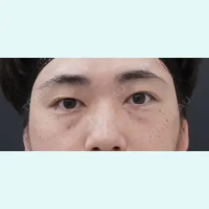 症例