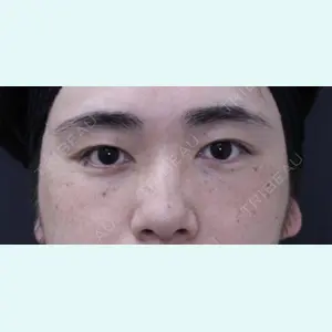 症例
