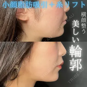 症例