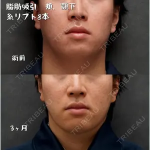 症例