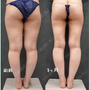 症例
