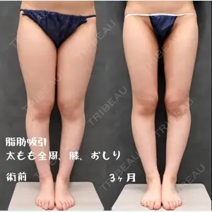 症例