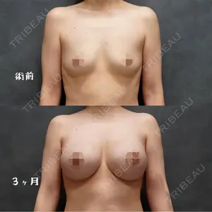 症例