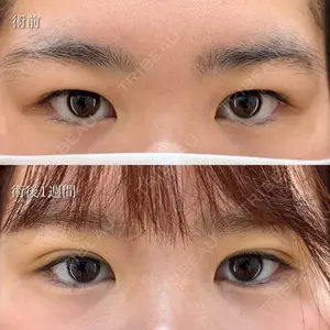 HAAB×DREAM BEAUTY CLINIC 東京本院 萩原 昂医師の症例