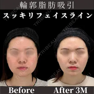 症例