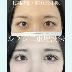 症例