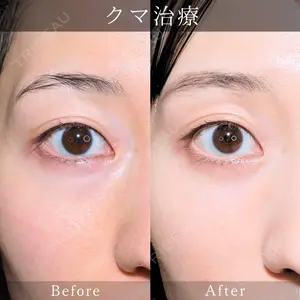 藤・ナチュレ美容クリニック 銀座院 小川 杏平医師の症例