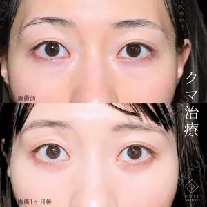 藤・ナチュレ美容クリニック 銀座院 小川 杏平医師の症例