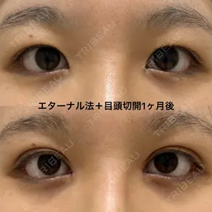 エターナル美容クリニック 久門田 詳医師の症例