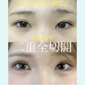 症例