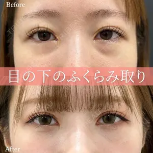 症例