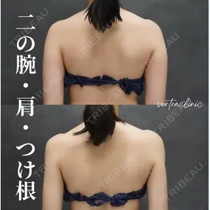 症例