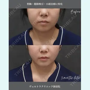 症例
