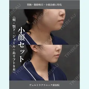症例