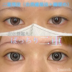 症例