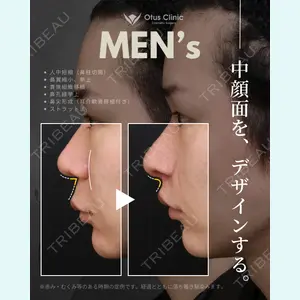 症例